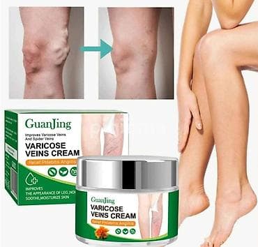 Guanjing Varikoz kremi Damar Məlhəmi effekti 💯% di 【Effektivlik】 — 1