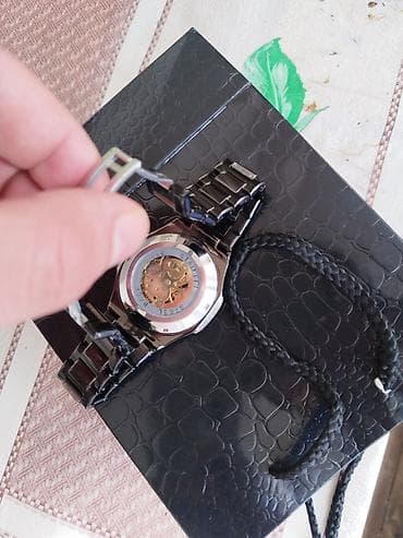 Digər: Normal — 2