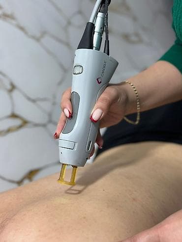 Lazer epilyatoru lalafo.az -da Lazer epilyatoru