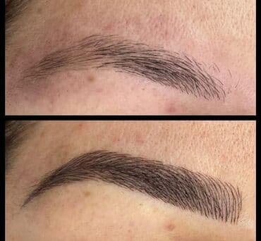 qısa saç modelləri: Seyrek formasiz qaslarin mikrobledinqle berpasi — 6