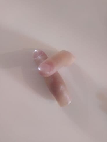 oksigen balonu icin reduktor: Turkiyenin "REHA The Art of Prosthetics" klinikasinda duzeldilib, Sol — 4