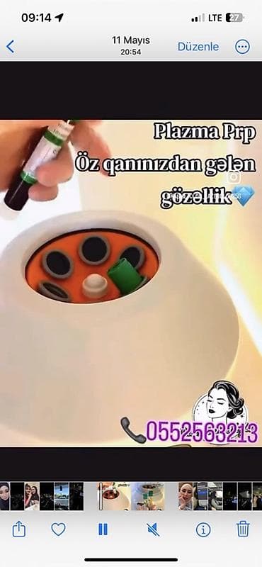 dodaq permanenti nedir: PRP plazma proseduru – “öz qanınızdan gələn gözəllik”. Xidmətin — 1