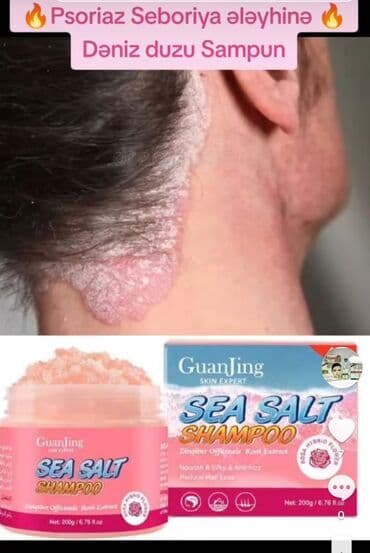 qaş sabitləyici: Deniz duzu sampunu 1.Psoriasis şampunu: Baş dərisi sedef xəstəliyi ilə — 1
