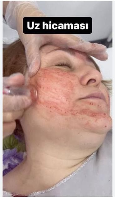 Обучение, курсы: Xidmət: Üz hicaması (quru/sürüşdürmə və yaş kəsiklərlə) Təsvir: - Üz — 2