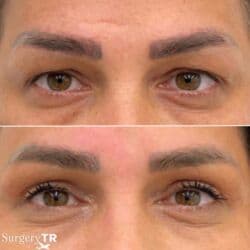 qarin eritmek ucun krem: Estetik–plastik cərrahiyyə və bədən formalaşdırma xidmətləri Təklif — 20