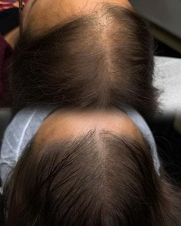 Bitki əsaslı Saç Bərkidici və Uzadıcı Serum Məhsul təsviri: - Təbii — 2