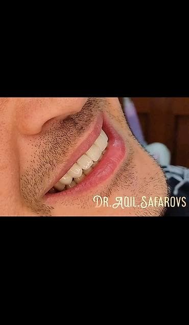 Ремонт техники: Stomatolojı Klinika Dentalux– təbii görünüşlü, parlaq gülümsəmə - — 7