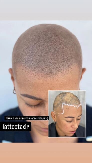 Sac similasyonu, tokulmus ve yanmis saclarin berpasi