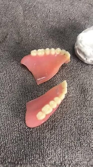 ustalar qrupu whatsapp: Qırılmiş cat, dişi duşmuş cixan protezlerin Hemin gun erzinde tez — 3