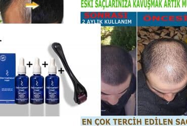 qara zire yagi: Saç üçün yağ, Saç tökülməsinə qarşı, Yeni, Pulsuz çatdırılma — 1