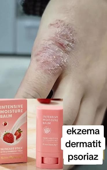 a e vitamini krem: Krem psoriaz, ekzema, gobelek eleyhine — 1