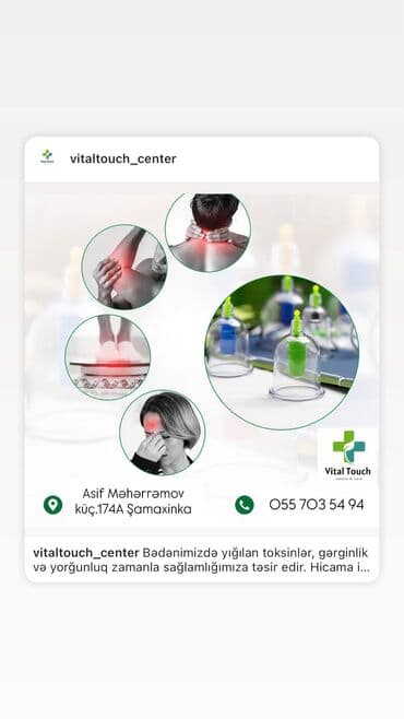 ağ dırnaq modelleri: 💆‍♀️ Peşəkar masaj və hicama xidməti — rahatlıq və sağlamlıq bir — 6