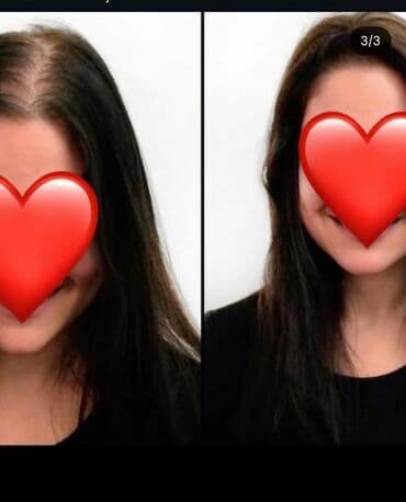 таблетки для похудения в баку: Saç üçün yağ, Saç tökülməsinə qarşı — 6