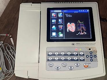 Elektrokardioqraf (EKQ) aparatı Contec ECG1200G. 12 kanallı, tam idial — 3
