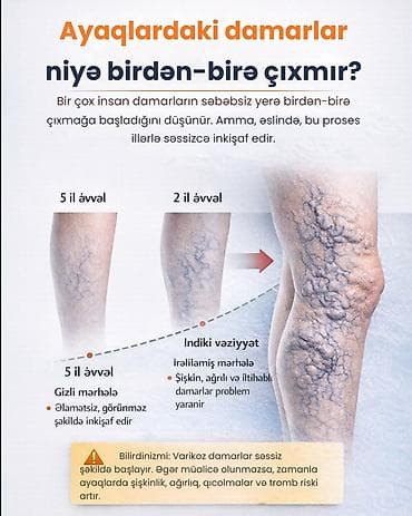 devalt lazer: Varikoz müalicəsi, Klinikada — 1