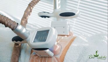 qarin ve bel piylerini eritmek: Cryo lipolysis (Cryo Shape) Piy qatları hədəfə alınır və 1 saat — 3