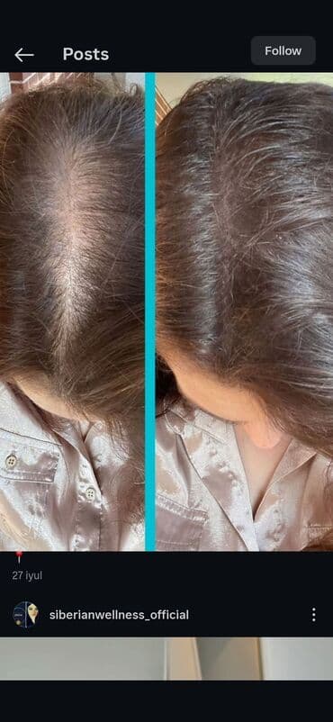 таблетки для похудения в баку: Saç üçün yağ, Saç tökülməsinə qarşı — 26
