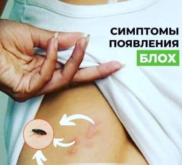 xalca yuma 1 50 azn 2023: Dezinfeksiya, dezinseksiya | Nəqliyyat — 13