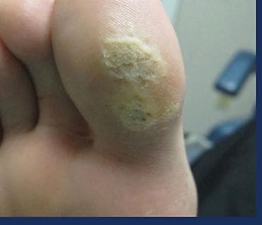 masaj bakida evde: Klassik masaj, Kişilər üçün — 3