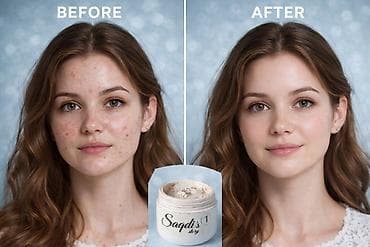 savis krem a e: Üz kremi — 2