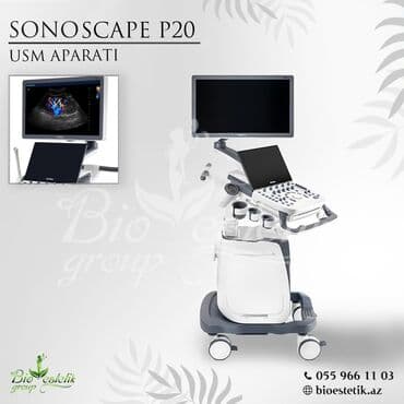 sentrafuqa aparati: USÇ (Uzi) aparati — 1