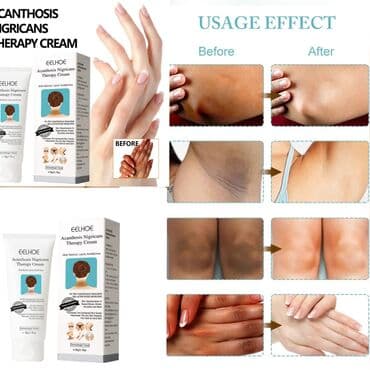 savis a e krem faydaları: Ağardıcı krem. Butun deri novlerine uyğundur və dərini — 1