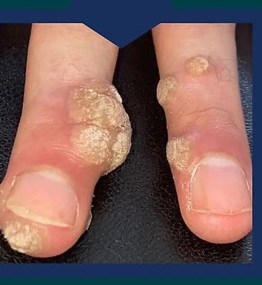 masaj bakida evde: Klassik masaj, Kişilər üçün — 2