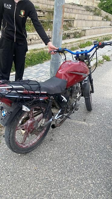 Əlim yandı !! 120 Azn xərci var SƏNƏDi YOXDU
