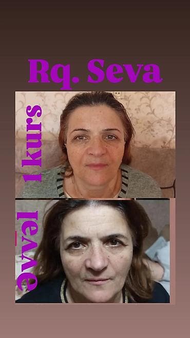 Xanımlar üçün kənar mudaxiləsiz yalniz əl ilə cavanlaşdırıcı masaj