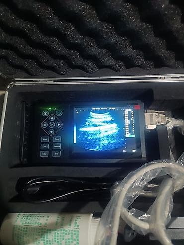 Tibbi avadanlıq: Daşınan ultrasəs diaqnostika cihazı (portable USG) Xüsusiyyətlər: - — 3