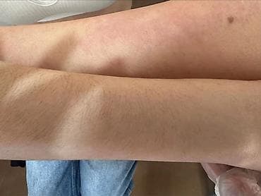 Красота и здоровье: Hirudoterapiya və Hicama (Qan çıxarma) xidməti - Hirudoterapiya — 9