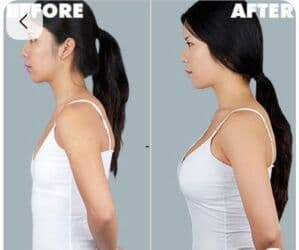 qarin eritmek ucun krem: Estetik–plastik cərrahiyyə və bədən formalaşdırma xidmətləri Təklif — 4