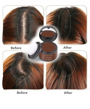 saç botoksu qiymeti: ❇️❇️Saç teni Keçəl yerləri doldurmaq üçen saç teni ❇️❇️❤️ 2 rəng — 5