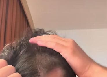 at quyrugu: EMBEAUTY 9 Aktivli – Dökülən və gec uzayan saçlar üçün dolğunlaşdırıcı — 3