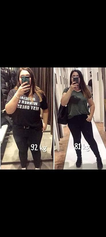 Əməkdaş axtarışı (vakansiyalar): Tibbi və Müalicəvi xidmət olaraq fəaliyyət göstərirəm.Qarın və Yan — 1