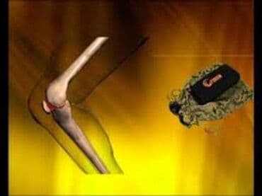 Digər tibbi məhsullar: DIZLIK KƏMƏRİ: kemerde hec bir batareya yoxdur.Sadece deriye temas — 4