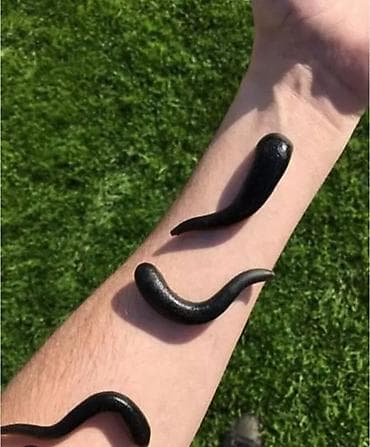 gozelik salon: Məhsul: Tibbi zəlili 1 ədədi 2 azn — 3