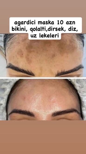 маска ламинария от пигментных пятен: Крем для лица, Для всех типов кожи, Новый, Бесплатная доставка — 4