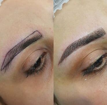 qısa saç modelləri: Seyrek formasiz qaslarin mikrobledinqle berpasi — 2