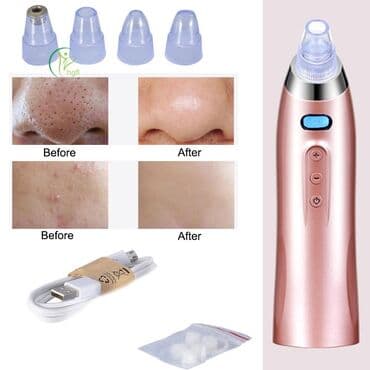 Almaz dermabraziya, Üz üçün, Təlim keçirilir lalafo.az -da Almaz dermabraziya, Üz üçün, Təlim keçirilir