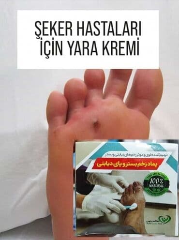 Yeni mehsulumuz Şəkərli diabet xesdelerinde yaranmis gec sağqlan lalafo.az -da Yeni mehsulumuz Şəkərli diabet xesdelerinde yaranmis gec sağqlan