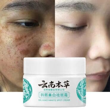 Üz kremi, Yeni, Ödənişli çatdırılma, Rayonlara çatdırılma, Ünvandan götürmə lalafo.az -da Üz kremi, Yeni, Ödənişli çatdırılma, Rayonlara çatdırılma, Ünvandan götürmə