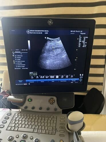 GE Healthcare LOGIQ P6 ultrasəs diaqnostika sistemi - Tam funksional lalafo.az -da GE Healthcare LOGIQ P6 ultrasəs diaqnostika sistemi - Tam funksional