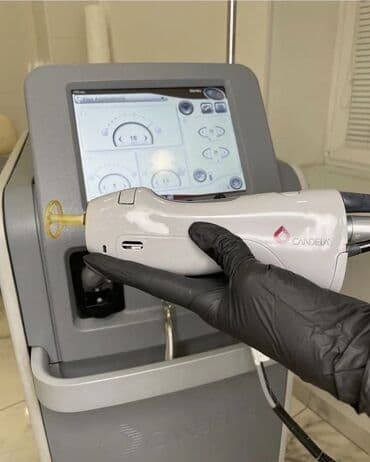 Epilyasiya üçün, Aleksandrit lalafo.az -da Epilyasiya üçün, Aleksandrit