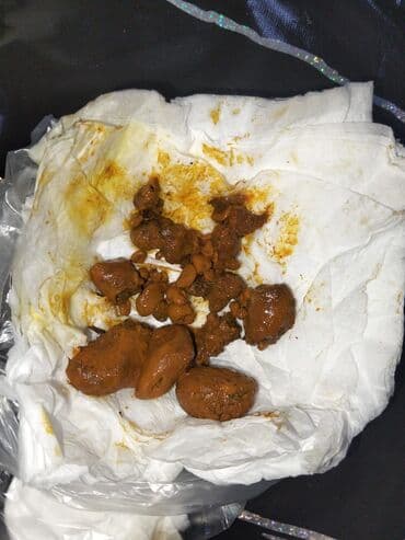 Məhsul: Öd daşı (qurudulmuş) Təsvir: - Təbii mənşəli, müxtəlif ölçülü lalafo.az -da Məhsul: Öd daşı (qurudulmuş) Təsvir: - Təbii mənşəli, müxtəlif ölçülü