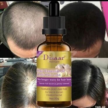 Disaar zencefil serum -Saç tökülməyə qarşı lasyon bitkiseldir lalafo.az -da Disaar zencefil serum -Saç tökülməyə qarşı lasyon bitkiseldir