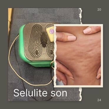 Masajor, Selülit əleyhinə masajor, Bədən üçün lalafo.az -da Masajor, Selülit əleyhinə masajor, Bədən üçün