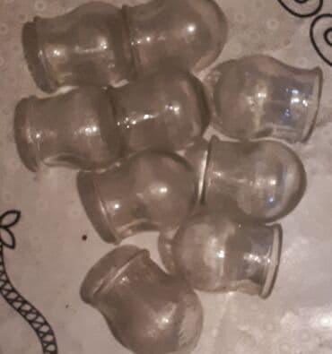 Крышки: Bele qoyulması üçün bankalar.9 ededdir at lalafo.az — 1 Крышки: Bele qoyulması üçün bankalar.9 ededdir — 1