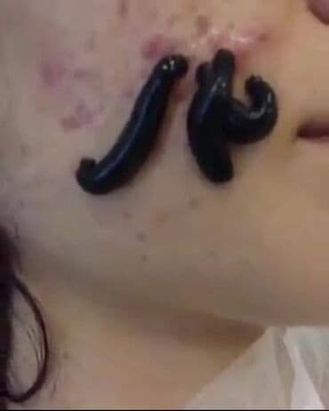 Mualicevi tibbi zeli keyfiyetne ve tebyliyne zemanet qiymet 1 ededi 2 lalafo.az -da Mualicevi tibbi zeli keyfiyetne ve tebyliyne zemanet qiymet 1 ededi 2