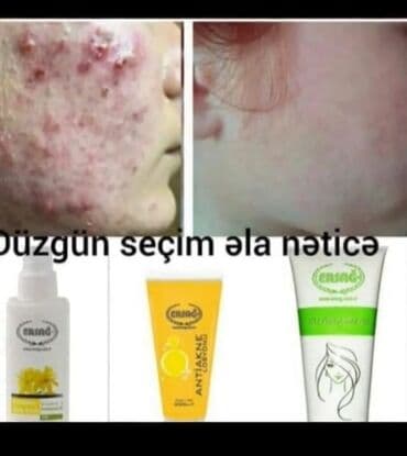 Üz kremi, Akneyə meyilli dəri üçün lalafo.az -da Üz kremi, Akneyə meyilli dəri üçün